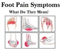 The bottoms of the feet might not get as much respect as they deserve. Foot Pain Chart