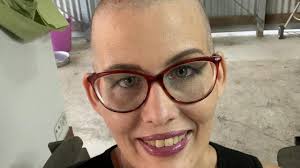 Proserpine cancer shave heads
