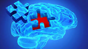 Petersen rc, aisen ps, beckett la, et al: Alzheimer Vorbeugen 6 Tipps Um Dem Vergessen Entgegenzuwirken Posts Mondosano
