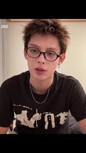 James Plaster in His Face