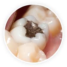 En général, on dit qu'un cycle complet de digestion dure 24h. Abces Dentaire Traitement Causes Et Diagnostic