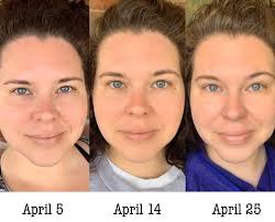 Consistent skincare routine for better texture