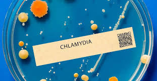 Image result for chlamydia symptoms