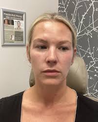 Caroline Garrett (@prestigecarolinenp) • Instagram photos and videos