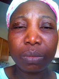 Photos: Ex-Workers allege poor conditions, unfair treatment in lawsuit