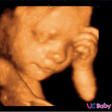 Pin On Uc Baby 3d 4d Hd Ultrasound Images