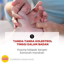 Ada juga tanda tanda kolesterol tinggi yang lain. Tanda Tanda Kolesterol Tinggi Motivasi Media Sosial Facebook