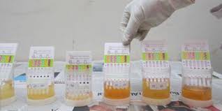 Maybe you would like to learn more about one of these? Urine Seorang Bintara Polda Sumsel Diduga Mengandung Zat Narkotika Merdeka Com