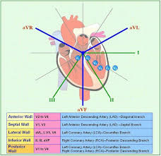 Mi Location Chart Cardiac Nursing Icu Nursing Cardiology