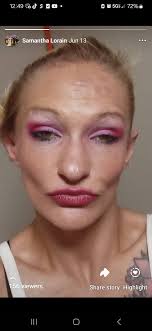 Samantha shares her recovery story