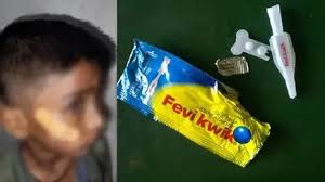 Nurse in Karnataka uses Fevikwik instead of stitches to treat boy's deep  wound - INDIA - GENERAL | Kerala Kaumudi Online