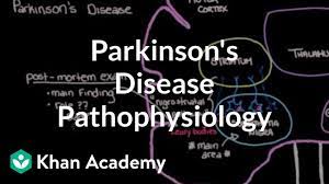Feb 23, 2017 · the pathophysiology of parkinson's disease (pd) is only partially understood, although considerable progress has been made. Putting It All Together Pathophysiology Of Parkinson S Disease Nclex Rn Khan Academy Youtube