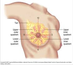As a result, half of all breast. Breast Disease Add On Lecture Flashcards Quizlet