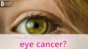If your skin changes color, make an appointment with your primary care physician or dermatologist. How Do You Know If You Have Eye Cancer Dr Sunita Rana Agarwal Youtube