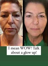 Canadian-made hydrolyzed marine collagen supplements