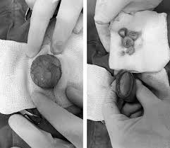 Bladder Stone Removal Surgery For Pets And Dogs Seah