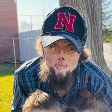 Fundraiser by Holly Hamilton : Help Restore His Smile, Breathing, and Vision