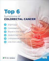 Image result for Constipation in Cancer