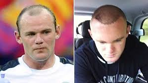 Wayne rooney ingiltere'den eski futbolcu santrafor son kulüp: Ist Noch Blutig Rooney Nimmt Haartransplantation Mit Humor Krone At