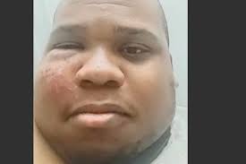 Fundraiser for David Reevers by David Reevers : Support Andrew's Recovery  After Accident