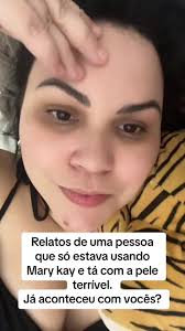 Minha pele tá terrível devido os produtos rosas mary kay. Alguem mais teve  reação? #alergia #pele #marykay #cuidadoscomapele