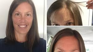 Deborah Hutton gives candid health update to Spotlight after skin cancer  surgery