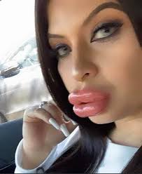 👀 some people say “duck lips” but this is toilet plunger lips level.