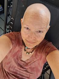 Celebrating Life After Overcoming Multiple Surgeries and Breast Cancer