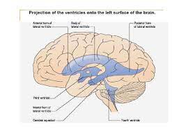 3 Ventriculo Del Cerebro Novocom Top