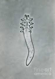 Image result for Demodex folliculorum