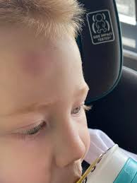 My KG got hurt today dealing w a teacher, who does interventions and other  work for the KG class. This is not the first time he has said, she pull him  and