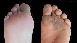 It lies directly in front of the iris and pupil, and allows light to enter the eye. Studie Von Harvard Forschern Die Hornhaut An Den Fussen Hat Viele Vorteile