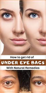 How To Get Rid Of Under Eye Bags With Natural Remedies The Glow Pink In 2020 Under Eye Bags Eye Bags Treatment Eye Bags