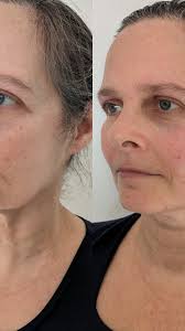 Facial reflexology mixed with gua sha and massage 👌✨