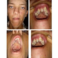 Fundraiser by Helena Klassen : Medical expense for Jacob Wiebe