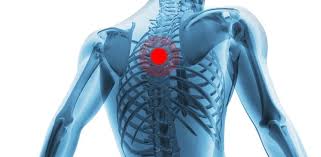 In the upper back region, the trapezius, rhomboid major, and levator scapulae muscles anchor the scapula and clavicle to the spines in addition to moving the arm and pectoral girdle, muscles of the chest and upper back work together as a group to support the. Upper Back Pain Pain Doctor