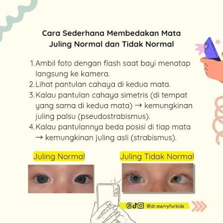 Mata Bayi Terlihat Juling? Ini Penjelasan Medisnya! Wajar lho kalau mata  bayi terlihat juling di awal-awal kehidupan mereka. Hingga usia 4 bulan,  otot mata bayi masih belajar berkoordinasi. Tapi, kapan ini jadi