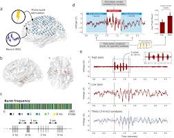Individual, surgery, vascular surgery, 6 healthcare dr ste 1 Theta Burst Stimulation Entrains Frequency Specific Oscillatory Responses Brain Stimulation Basic Translational And Clinical Research In Neuromodulation