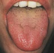 Ayurvedic Tongue Analysis What Does Your Tongue Say About