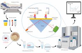 Typhoid is a serious condition that can have fatal consequences. Diagnostics Free Full Text Laboratory Diagnosis Of Paratyphoid Fever Opportunity Of Surface Plasmon Resonance Html