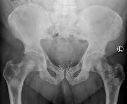 Pin On Radiology