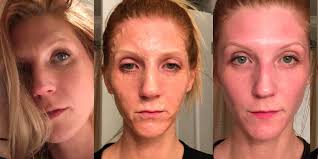 Blend everything together in a coffee grinder. 10 Face Masks With Before And After Photos That Will Make You A Believer