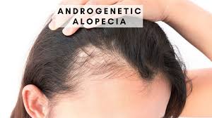 Hair grows everywhere on the human skin except on places like the palms of our hands each follicle has its own life cycle that can be influenced by age, disease, and a wide variety of men with this condition, called male pattern baldness, can begin suffering hair loss as early as. Teenagers Hair Loss Is Covid 19 Responsible For Premature Baldness