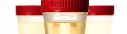 How long do opiates stay in urine for chronic users. Opioid Testing Lab Tests Online