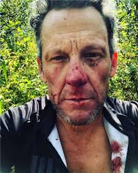 Lance Armstrong donates $10,000 to Adrien Costa who lost leg in climbing  accident