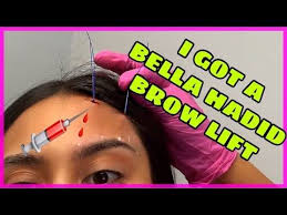 From waxing, plucking, threading, and everything in between, our eyebrows are one of the most important. Omg I Got A Bella Hadid Brow Lift Did It Hurt Pdo Thread Lift Thread Lift Eyebrow Lift Brow Lift