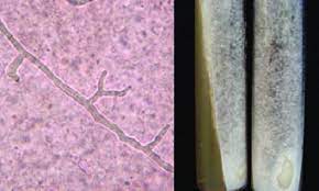 La mucormicosis es una enfermedad de muy baja frecuencia. Examen Directo Con Hifas Cenociticas Dicotomicas Koh 10x 40x Download Scientific Diagram