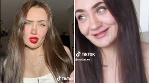 Una joven de 24 años muestra con orgullo su dentadura postiza: “Hasta el  año pasado ocultaba constantemente mi sonrisa”