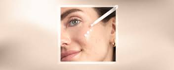 Image result for Alpha-Hydroxy acid