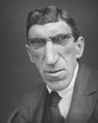 Derek Greenberg, Beanpole, etc.